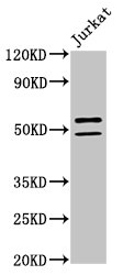 NOVA1 Antibody - Positive Western Blot detected in Jurkat whole cell lysate. All lanes: NOVA1 antibody at 2 µg/ml Secondary Goat polyclonal to rabbit IgG at 1/50000 dilution. Predicted band size: 53, 20, 50, 51 KDa. Observed band size: 53, 50 KDa