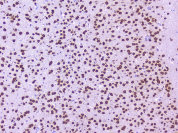 NOVA1 Antibody - IHC staining of FFPE mouse brain with NOVA1 antibody at 1ug/ml. HIER: boil tissue sections in pH6, 10mM citrate buffer, for 10-20 min followed by cooling at RT for 20 min.