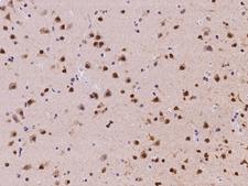 NOVA1 Antibody - Immunochemical staining of human NOVA1 in human brain with rabbit polyclonal antibody at 1:500 dilution, formalin-fixed paraffin embedded sections.