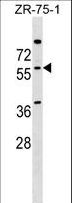NOVA2 Antibody - NOVA2 Antibody western blot of ZR-75-1 cell line lysates (35 ug/lane). The NOVA2 antibody detected the NOVA2 protein (arrow).