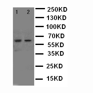 NOX1 Antibody - WB of NOX1 antibody. Lane 1: HELA Cell Lysate. Lane 2: MCF-7 Cell Lysate..