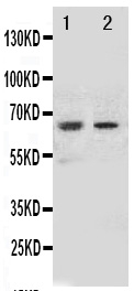NOX1 Antibody - Anti-NOX1 antibody, Western blotting All lanes: Anti NOX1 at 0.5ug/ml Lane 1: HELA Whole Cell Lysate at 40ug Lane 2: MCF-7 Whole Cell Lysate at 40ug Predicted bind size: 65KD Observed bind size: 65KD