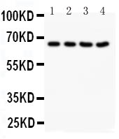 NOX1 Antibody - Anti-NOX1 antibody, Western blotting Lane 1: Rat Heart Tissue LysateLane 2: Rat Brain Tissue LysateLane 3: Mouse Heart Tissue LysateLane 4: Mouse Heart Tissue Lysate