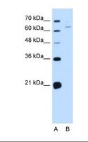 NOX1 Antibody - Lane A: Marker. Lane B: Jurkat cell lysate. Antibody concentration: 0.5 ug/ml. Gel concentration: 12%.  This image was taken for the unconjugated form of this product. Other forms have not been tested.