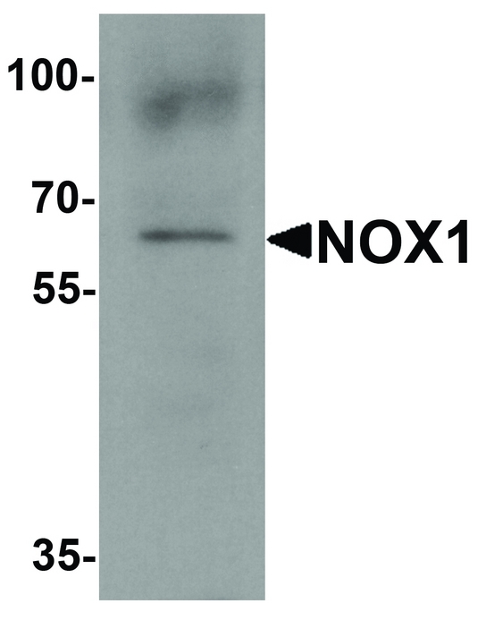 NOX1 Antibody - Western blot analysis of NOX1 in 293 cell lysate with NOX1 antibody at 1 ug/ml.