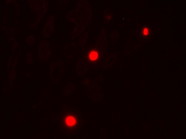 NOX1 Antibody - Immunofluorescence of NOX1 in human kidney tissue with NOX1 antibody at 20 ug/ml.