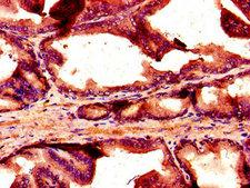 NOX1 Antibody - Immunohistochemistry image of paraffin-embedded human prostate tissue at a dilution of 1:100