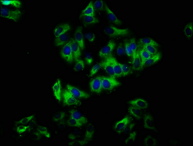 NOX1 Antibody - Immunofluorescence staining of HepG2 cells with NOX1 Antibody at 1:33, counter-stained with DAPI. The cells were fixed in 4% formaldehyde, permeabilized using 0.2% Triton X-100 and blocked in 10% normal Goat Serum. The cells were then incubated with the antibody overnight at 4°C. The secondary antibody was Alexa Fluor 488-congugated AffiniPure Goat Anti-Rabbit IgG(H+L).