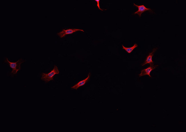 NOX1 Antibody - Staining HeLa cells by IF/ICC. The samples were fixed with PFA and permeabilized in 0.1% Triton X-100, then blocked in 10% serum for 45 min at 25°C. The primary antibody was diluted at 1:200 and incubated with the sample for 1 hour at 37°C. An Alexa Fluor 594 conjugated goat anti-rabbit IgG (H+L) Ab, diluted at 1/600, was used as the secondary antibody.