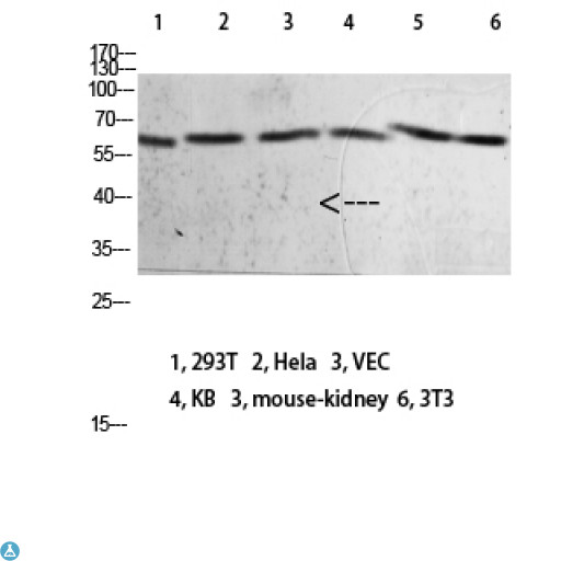 NOX1 Antibody - Western blot analysis of 293T Hela VEC KB mouse-kidney 3T3 lysate, antibody was diluted at 2000. Secondary antibody was diluted at 1:20000.