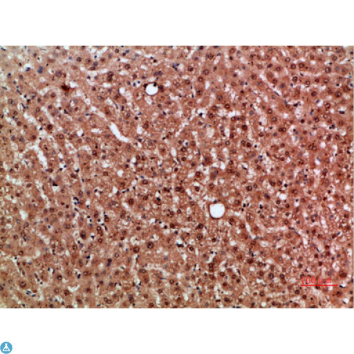 NOX1 Antibody - Immunohistochemical analysis of paraffin-embedded human-liver, antibody was diluted at 1:200.