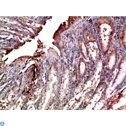 NOX1 Antibody - Immunohistochemical analysis of paraffin-embedded human-stomach, antibody was diluted at 1:200.