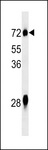 NOX3 Antibody - NOX3 Antibody western blot of mouse liver tissue lysates (35 ug/lane). The NOX3 Antibody detected the NOX3 protein (arrow).