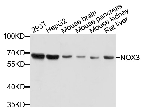 NOX3 Antibody - Western blot analysis of extracts of various cells.