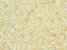 NOX3 Antibody - Immunohistochemistry of paraffin-embedded human liver tissue at dilution 1:100