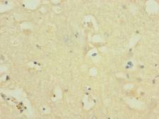 NOX3 Antibody - Immunohistochemistry of paraffin-embedded human brain tissue at dilution 1:100