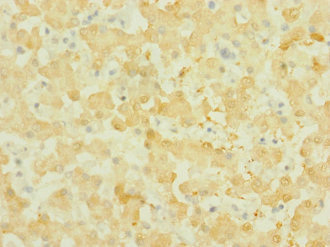 NOX3 Antibody - Immunohistochemistry of paraffin-embedded human liver tissue at dilution 1:100