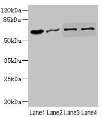 NOX3 Antibody - Western blot All Lanes: NOX3antibody at 0.96ug/ml Lane 1: Mouse kidney tissue Lane 2: 293T whole cell lysate Lane 3: HepG-2 whole cell lysate Lane 4: Hela whole cell lysate Secondary Goat polyclonal to rabbit IgG at 1/10000 dilution Predicted band size: 65 kDa Observed band size: 65 kDa