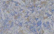 NOX3 Antibody - 1:100 staining human lymph node tissue by IHC-P. The sample was formaldehyde fixed and a heat mediated antigen retrieval step in citrate buffer was performed. The sample was then blocked and incubated with the antibody for 1.5 hours at 22°C. An HRP conjugated goat anti-rabbit antibody was used as the secondary.