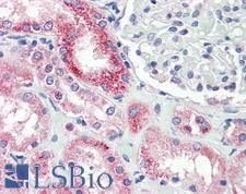 NOX4 Antibody - Anti-NOX4 antibody IHC staining of human kidney. Immunohistochemistry of formalin-fixed, paraffin-embedded tissue after heat-induced antigen retrieval.  This image was taken for the unconjugated form of this product. Other forms have not been tested.