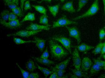 NOX4 Antibody - Detection of NOX4 in proximal convoluted tubules of the kidney using antibody at 5 ug/ml.  This image was taken for the unconjugated form of this product. Other forms have not been tested.