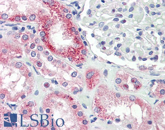 NOX4 Antibody - Anti-NOX4 antibody IHC staining of human kidney. Immunohistochemistry of formalin-fixed, paraffin-embedded tissue after heat-induced antigen retrieval.  This image was taken for the unconjugated form of this product. Other forms have not been tested.