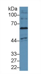 NOX4 Antibody - Western Blot; Sample: Human Hela cell lysate; Primary Ab: 1µg/ml Rabbit Anti-Human NOX4 Antibody Second Ab: 0.2µg/mL HRP-Linked Caprine Anti-Rabbit IgG Polyclonal Antibody