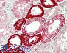 NOX4 Antibody - Human Kidney: Formalin-Fixed, Paraffin-Embedded (FFPE).  This image was taken for the unconjugated form of this product. Other forms have not been tested.