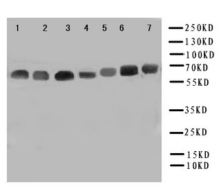 NOX4 Antibody - WB of NOX4 antibody. Lane 1: Rat Kidney Tissue Lysate. Lane 2: Rat Cardiac Muscle Tissue Lysate. Lane 3: Rat Spleen Tissue Lysate. Lane 4: HELA Cell Lysate. Lane 5: 293T Cell Lysate. Lane 6: MCF-7 Cell Lysate. Lane 7: SMMC Cell Lysate.