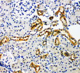 NOX4 Antibody - NOX4 antibody. IHC(P): Rat Kidney Tissue.
