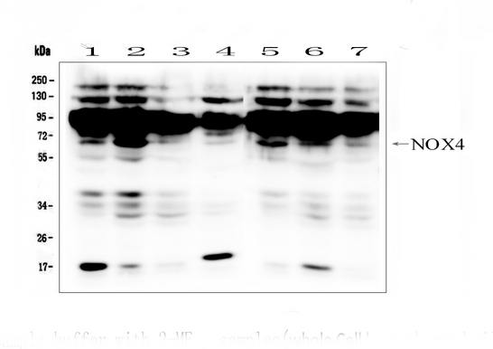 NOX4 Antibody - Western blot analysis of NADPH oxidase 4/NOX4 using anti-NADPH oxidase 4/NOX4 antibody. Electrophoresis was performed on a 5-20% SDS-PAGE gel at 70V (Stacking gel) / 90V (Resolving gel) for 2-3 hours. The sample well of each lane was loaded with 50ug of sample under reducing conditions. Lane 1: human HepG2 whole cell lysates, Lane 2: human SW620 whole cell lysates, Lane 3: human HK-2 whole cell lysates, Lane 4: human HL-60 whole cell lysates, Lane 5: human 293T whole cell lysates, Lane 6: human SW579 whole cell lysates, Lane 7: human SK-OV-3 whole cell lysates. After Electrophoresis, proteins were transferred to a Nitrocellulose membrane at 150mA for 50-90 minutes. Blocked the membrane with 5% Non-fat Milk/ TBS for 1.5 hour at RT. The membrane was incubated with rabbit anti-NADPH oxidase 4/NOX4 antigen affinity purified polyclonal antibody at 0.5 µg/mL overnight at 4°C, then washed with TBS-0.1% Tween 3 times with 5 minutes each and probed with a goat anti-rabbit IgG-HRP secondary antibody at a dilution of 1:10000 for 1.5 hour at RT. The signal is developed using an Enhanced Chemiluminescent detection (ECL) kit with Tanon 5200 system. A specific band was detected for NADPH OXIDASE 4/NOX4 at approximately 67KD. The expected band size for NADPH OXIDASE 4/NOX4 is at 67KD.