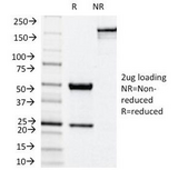 NOX4 Antibody - SDS-PAGE Analysis of Purified, BSA-Free NOX4 Antibody (clone NOX4/1245). Confirmation of Integrity and Purity of the Antibody.