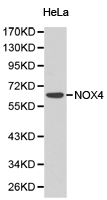 NOX4 Antibody - Western blot of extracts of HeLa cell line, using NOX4 antibody.