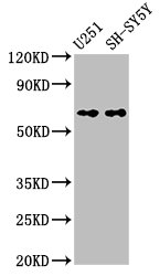NOX4 Antibody - Western Blot Positive WB detected in: U251 whole cell lysate, SH-SY5Y whole cell lysate All lanes: Nox4 antibody at 3.3µg/ml Secondary Goat polyclonal to rabbit IgG at 1/50000 dilution Predicted band size: 67 kDa Observed band size: 67 kDa
