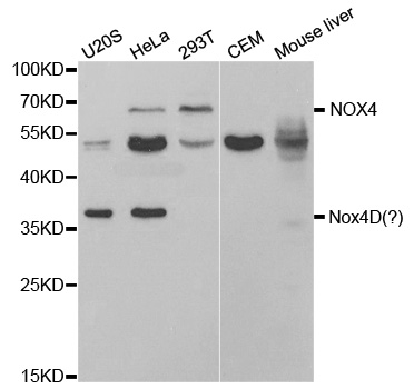 NOX4 Antibody - Western blot analysis of extracts of various cell lines, using NOX4 antibody.