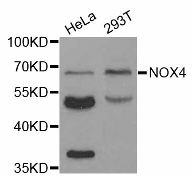 NOX4 Antibody - Western blot analysis of extracts of various cell lines.