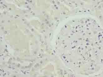 NOX4 Antibody - Immunohistochemistry of paraffin-embedded human kidney tissue using antibody at dilution of 1:100.