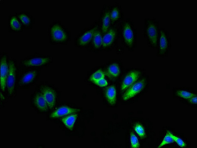 NOX4 Antibody - Immunofluorescent analysis of HepG2 cells using NOX4 Antibody at dilution of 1:100 and Alexa Fluor 488-congugated AffiniPure Goat Anti-Rabbit IgG(H+L)