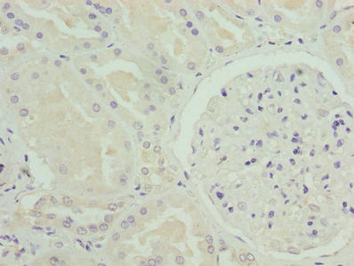 NOX4 Antibody - Immunohistochemistry of paraffin-embedded human kidney tissue using NOX4 Antibody at dilution of 1:100