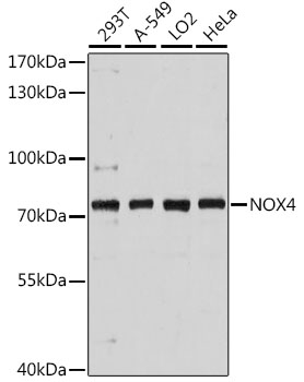 NOX4 Antibody - Western blot analysis of extracts of various cell lines, using NOX4 antibody at 1:3000 dilution. The secondary antibody used was an HRP Goat Anti-Rabbit IgG (H+L) at 1:10000 dilution. Lysates were loaded 25ug per lane and 3% nonfat dry milk in TBST was used for blocking. An ECL Kit was used for detection and the exposure time was 60s.