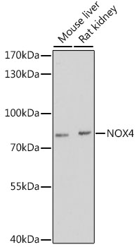 NOX4 Antibody - Western blot analysis of extracts of various cell lines, using NOX4 antibody at 1:3000 dilution. The secondary antibody used was an HRP Goat Anti-Rabbit IgG (H+L) at 1:10000 dilution. Lysates were loaded 25ug per lane and 3% nonfat dry milk in TBST was used for blocking. An ECL Kit was used for detection and the exposure time was 90s.