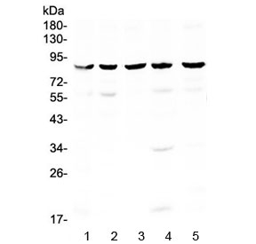 NOX4 Antibody - Western blot testing of human 1) HeLa, 2) MCF7, 3) HepG2, 4) A549 and 5) 293T cell lysate with NADPH oxidase 4 antibody at 0.5ug/ml. Expected molecular weight: ~65 kDa, 75-80 kDa.