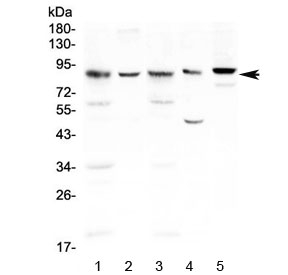 NOX4 Antibody - Western blot testing of 1) rat kidney, 2) rat NRK, 3) mouse kidney, 4) mouse HEPA1-6 and 5) mouse SP20 lysate with NADPH oxidase 4 antibody at 0.5ug/ml. Expected molecular weight: ~65 kDa, 75-80 kDa.