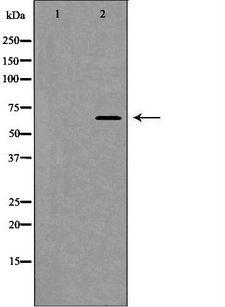 NOX4 Antibody - Western blot analysis of Jurkat whole cells lysates using NOX4 antibody. The lane on the left is treated with the antigen-specific peptide.