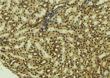 NOX4 Antibody - 1:100 staining mouse kidney tissue by IHC-P. The sample was formaldehyde fixed and a heat mediated antigen retrieval step in citrate buffer was performed. The sample was then blocked and incubated with the antibody for 1.5 hours at 22°C. An HRP conjugated goat anti-rabbit antibody was used as the secondary.