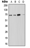 NOX4 Antibody - Western blot analysis of NOX4 expression in JAR (A); Jurkat (B); SP2/0 (C); PC12 (D) whole cell lysates.