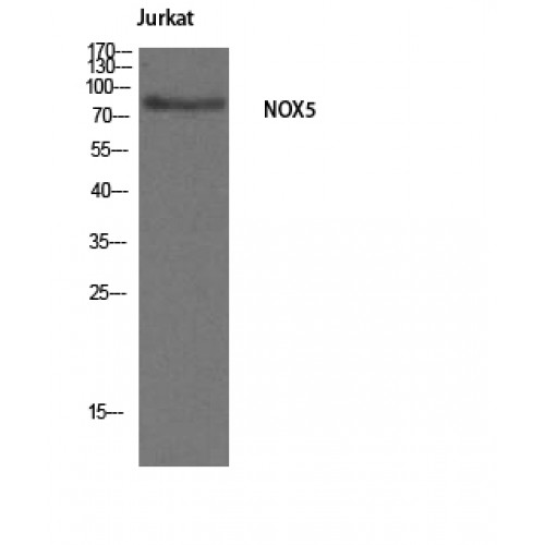 NOX5 Antibody - Western blot of Nox5 antibody