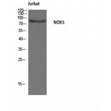 NOX5 Antibody - Western blot of Nox5 antibody