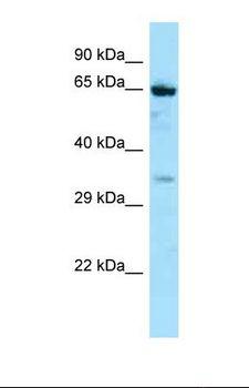 NOX5 Antibody - Western blot of Human Jurkat . NOX5 antibody dilution 1.0 ug/ml.  This image was taken for the unconjugated form of this product. Other forms have not been tested.