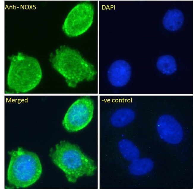 NOX5 Antibody - NOX5 antibody immunofluorescence analysis of paraformaldehyde fixed MCF7 cells, permeabilized with 0.15% Triton. Primary incubation 1hr (10ug/ml) followed by Alexa Fluor 488 secondary antibody (2ug/ml), showing vesicle staining. The nuclear stain is DAPI (blue).